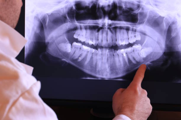 Best Emergency Root Canal Treatment in Port Byron, IL